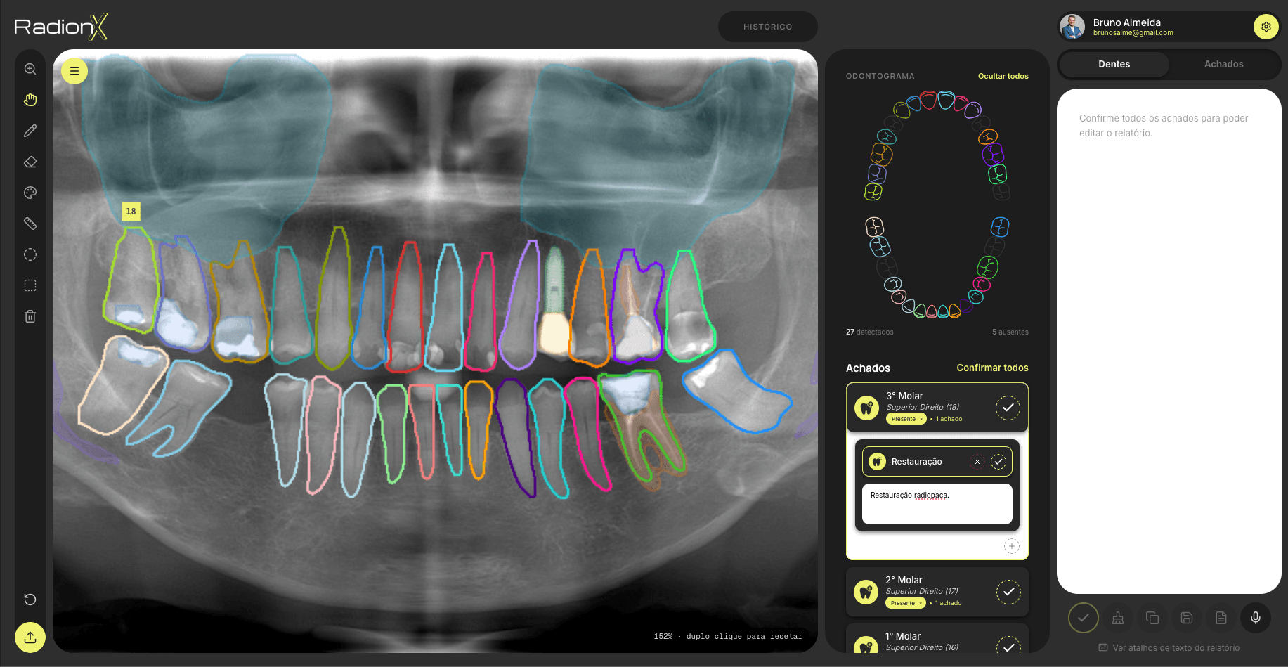Painel do RadionX segmentando e numerando dentes automaticamente em uma radiografia panorâmica